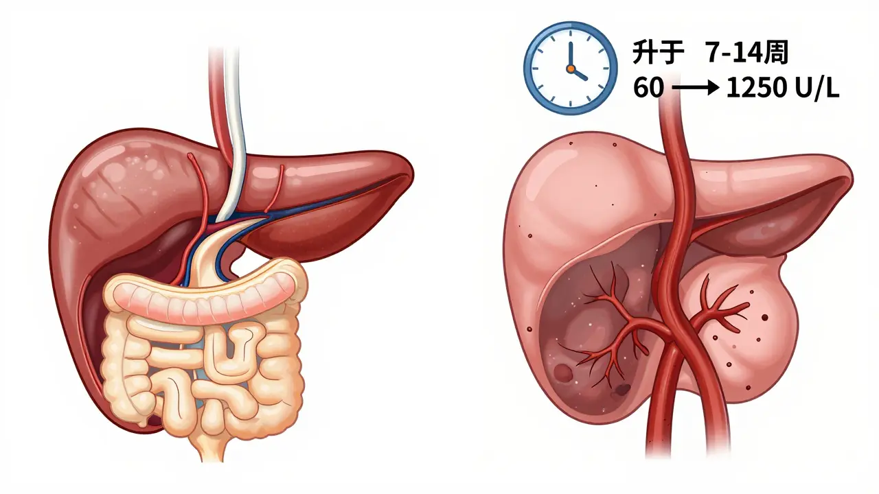 Side-by-side comparison of a healthy pancreas versus a necrotic one with rising lipase levels and time marker after drug exposure.
