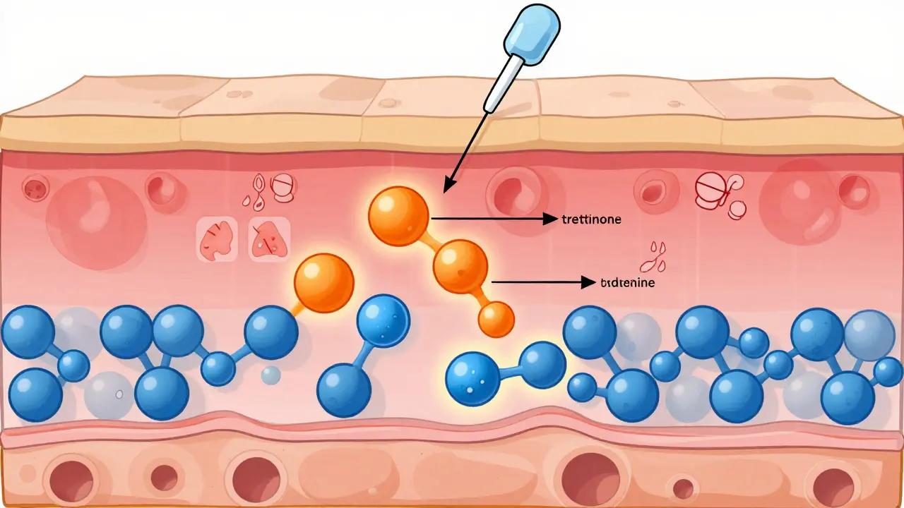 Retinoid Therapy: How Tretinoin and Adapalene Improve Skin